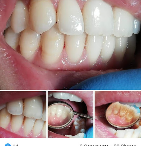 فن الأسنان - Dental Art