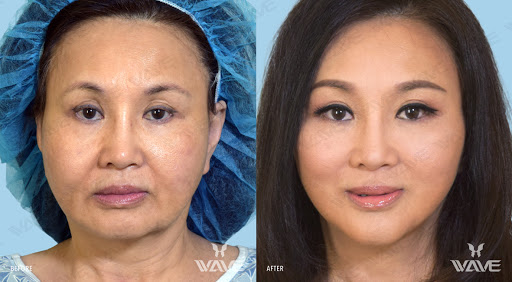 Wave Plastic Surgery & Aesthetic Laser Center Rowland Heights