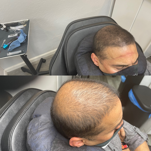 Explore sibling tattoo ideas for 2, creative tattoo ideas in Roseville, available at NuHair Ink. Scalp MicroPigmentation & Aesthetic Clinic of Sacramento