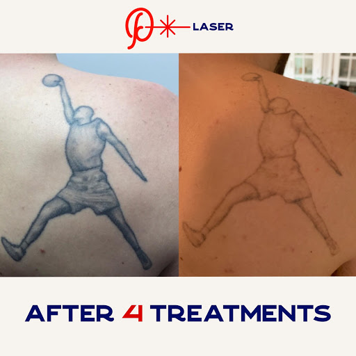 Explore taurus sign tattoo ideas, creative tattoo ideas in Easton, available at Precision Laser LLC