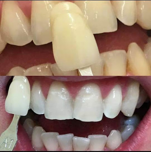 Tan-y-Graig ممارسة طب الأسنان - Tan-y-Graig Dental Practice