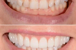 Bespoke Smile Marlow image