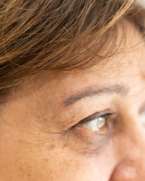 Photo n°6 de MY LASERSKIN à Seignosse ()