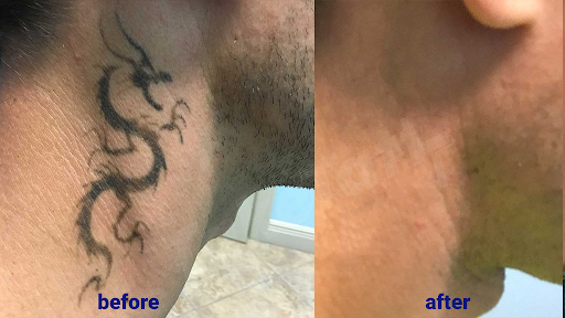 Explore tattoo ideas for behind ear, creative tattoo ideas in Sheffield Lake, available at TakeTatt Tattoo Removal