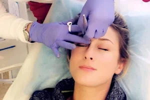 Kalon Microblading image