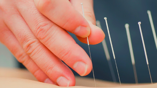 Acupuncture courses Mexico City