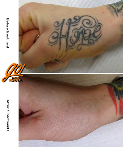 Explore song lyric tattoo ideas, creative tattoo ideas in Allentown, available at Removery Tattoo Removal & Fading