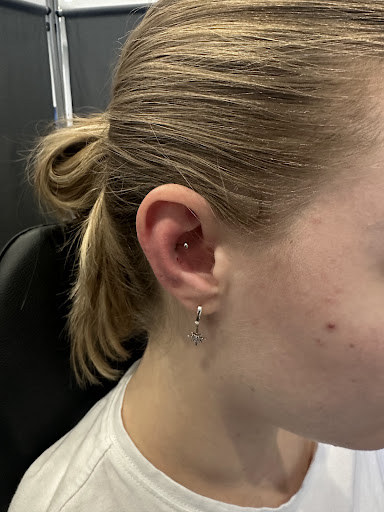 Explore tattoo ideas over scars, creative tattoo ideas in Chicago, available at Ultimate Sin Tattoo Piercing Parlor