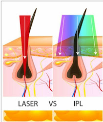 Cabinetul EPIL SPECIALIST Tecuci - Epilare Laser