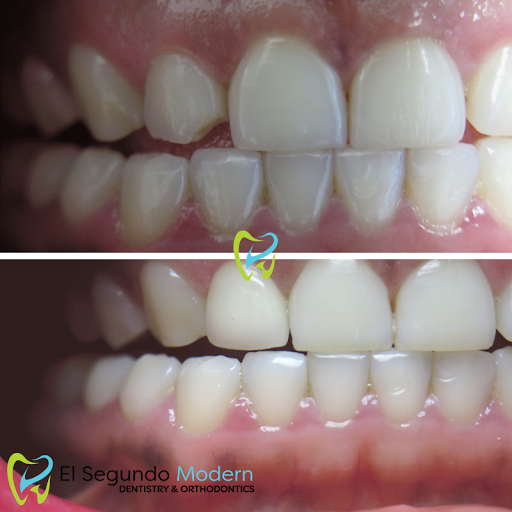 El Segundo Modern Dentistry image