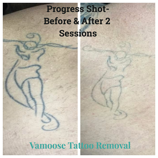 Explore flower wrist tattoo ideas, creative tattoo ideas in Chicago, available at Removery Tattoo Removal & Fading