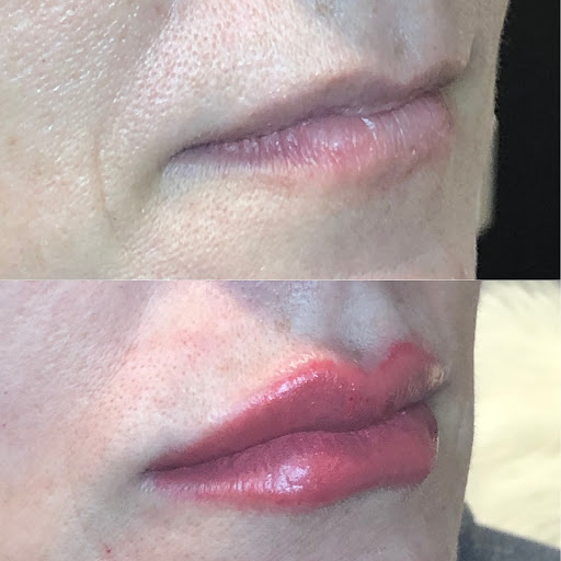 Explore mens collarbone tattoo ideas, creative tattoo ideas in Vancouver, available at All You Aesthetics and Permanent Cosmetics