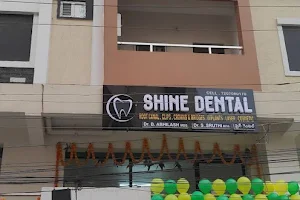 Shine dental image