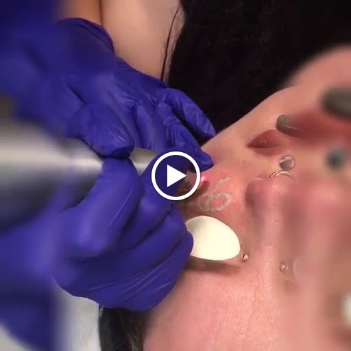 Explore tattoo background filler ideas, creative tattoo ideas in Pleasant Grove, available at Inklifters Tattoo Removal