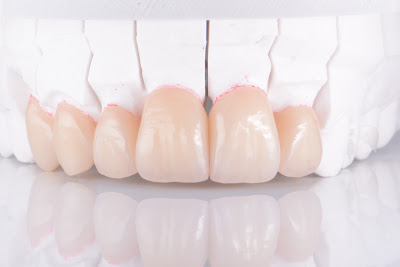 Laboratoire MAYÉ Dental Design à La Balme-de-Sillingy