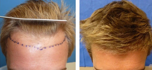 Meshkin Medical - Cosmetic Hair Restoration and Hair Transplant Clinic