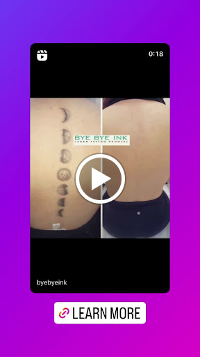 Find cool dog tattoo ideas for your next unique tattoo in Middle Village at Bye Bye Ink Laser Tattoo Removal