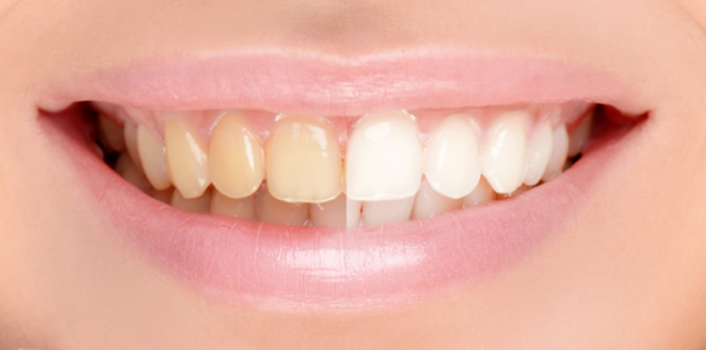 Reviews of Markham Associates Dental Surgeons in Reading - Dentist