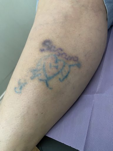 Explore never again tattoo ideas, creative tattoo ideas in Lake Jackson, available at Second Chance Laser Tattoo Removal