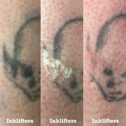 Explore assassins creed tattoo ideas, creative tattoo ideas in Pleasant Grove, available at Inklifters Tattoo Removal