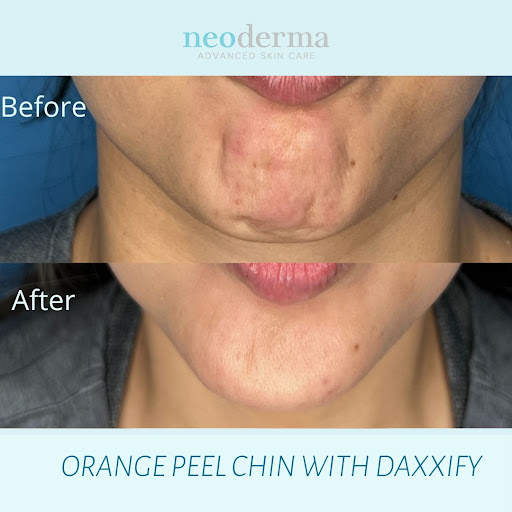 Explore tattoo ideas for memory of mom, creative tattoo ideas in Anaheim, available at Neoderma