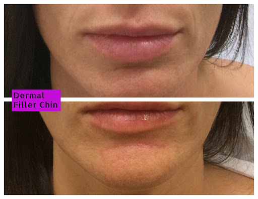 Explore tattoo ideas for grandma that passed away, creative tattoo ideas in Lake Oswego, available at Lake Oswego Vein and Aesthetic LOVA