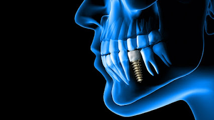 Dental Implants Institute of The West Coast