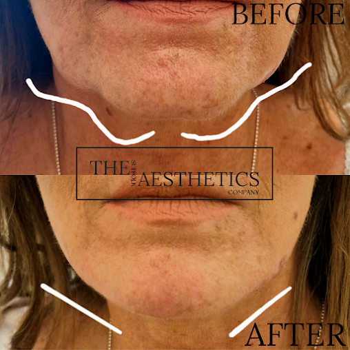 The Suffolk Aesthetics Company - The Suffolk Aesthetics Company