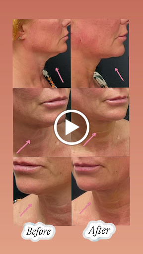 Explore georgia tattoo ideas, creative tattoo ideas in Lake Oswego, available at Lake Oswego Vein and Aesthetic LOVA