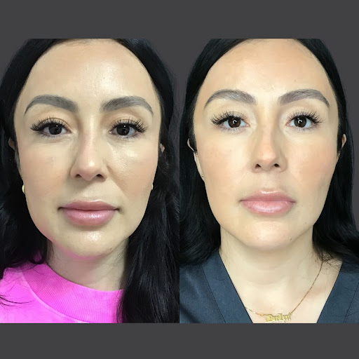 Explore female warrior tattoo ideas, creative tattoo ideas in Whittier, available at Skin Perfect Medical Aesthetics