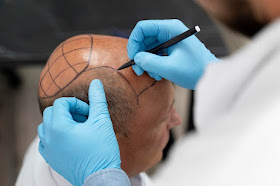Global Medical Care | Haartransplantation Türkei, Nasen Op Türkei, Bariatrische Operationen
