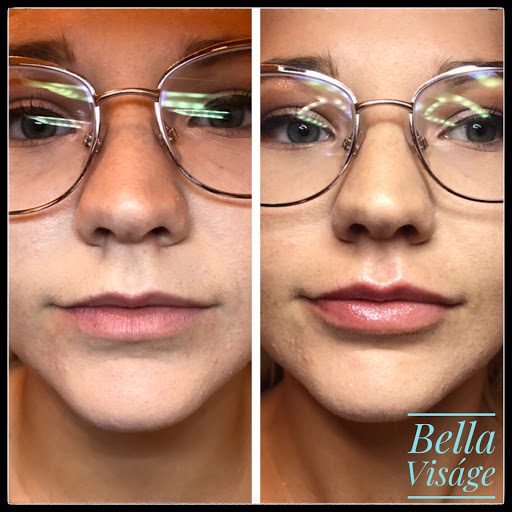 Explore moon and sun tattoo ideas, creative tattoo ideas in Lakeland, available at Bella Visge Medical & Aesthetic Rejuvenation