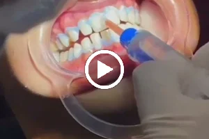 Hope Dental & Aesthetics| Top Dental, HydraFacial & Laser Treatments image