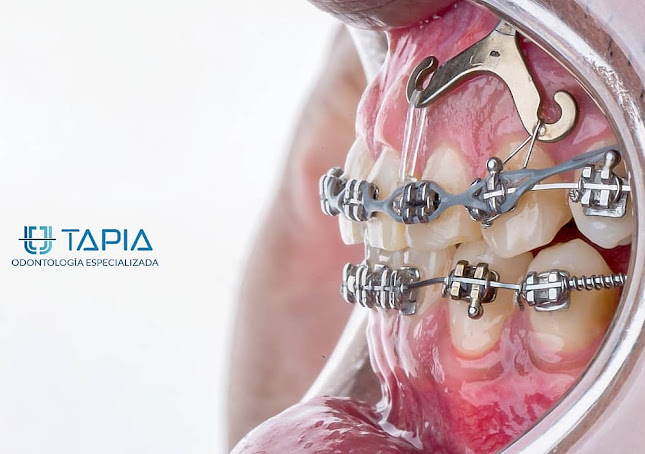 Clínica Dental Tapia - Cayma