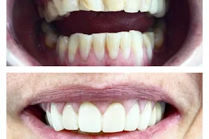 ד"ר רישרד סדון רופא שיניים נתניה Dr Richard Sadoun Dentiste Netanya image