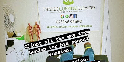 Teesside Cupping Services Ltd