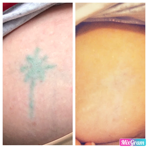 Explore mens back tattoo ideas, creative tattoo ideas in Longview, available at Vanish Laser Aesthetics