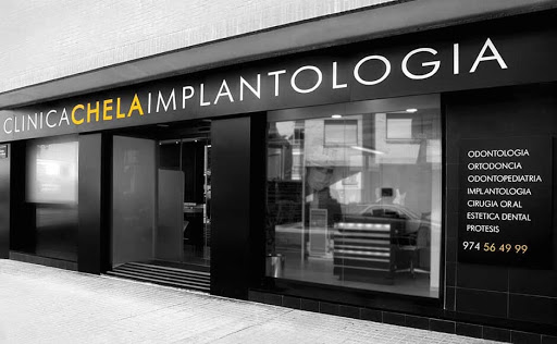 Clinica Dental Barbastro | Clinica Chela Implantologia en Barbastro, Huesca