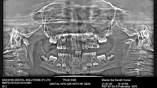 Rajaprabhu العناية بالأسنان - Rajaprabhu Dental Care