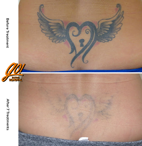 Explore leg tattoo ideas for men, creative tattoo ideas in Allentown, available at Removery Tattoo Removal & Fading