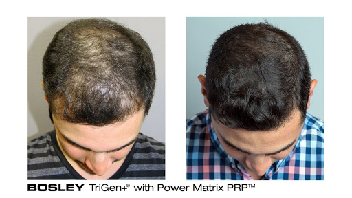 Hair Transplantation Clinic «Bosley Medical - Long Island», reviews and photos, 324 S Service Rd Suite 122, Melville, NY 11747, USA