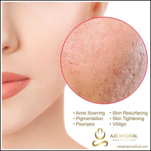 Find tattoo necklace ideas for your next unique tattoo in Raleigh at AJC Medical Aesthetics