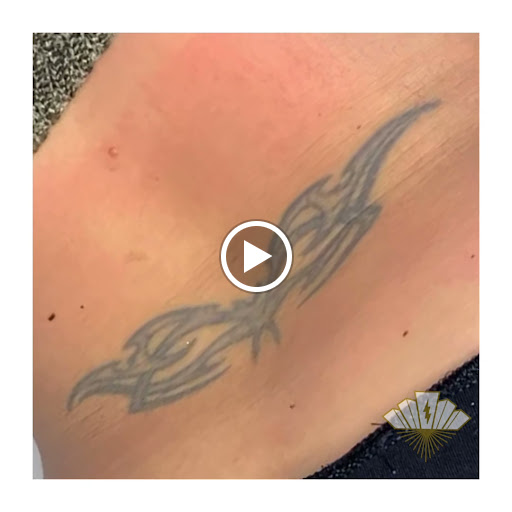 Explore thigh cover up tattoo ideas, creative tattoo ideas in Hatboro, available at Deleted Scene Tattoo Removal