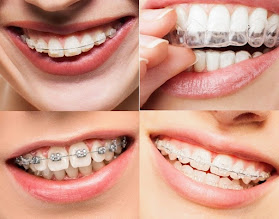 Clínica de las SONRISAS - Brackets, Estética dental, Implantes dentales en Lima norte