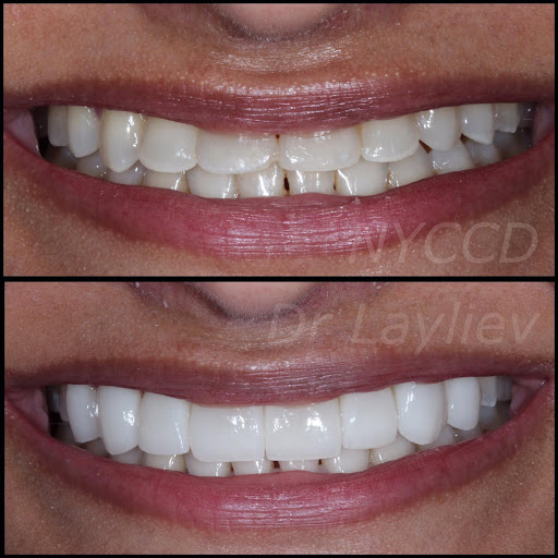 New York Center for Cosmetic Dentistry - Dr. Emanuel Layliev image 2