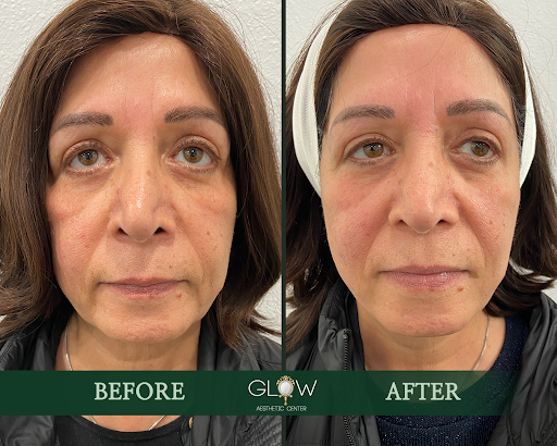 Glow Aesthetic Center Encino image