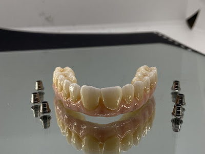 Dental Flux Numerique prothesiste dentaire à Trélivan