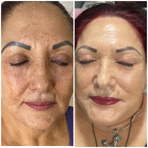 Explore bratz doll tattoo ideas, creative tattoo ideas in Tucson, available at Allure Medical