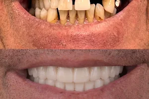Tampa Dental Implants image