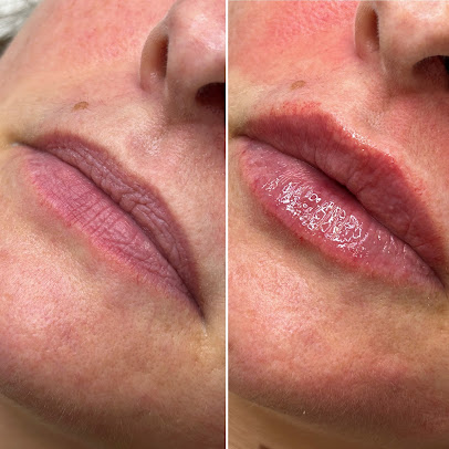 Aesthetics - Aesthetics